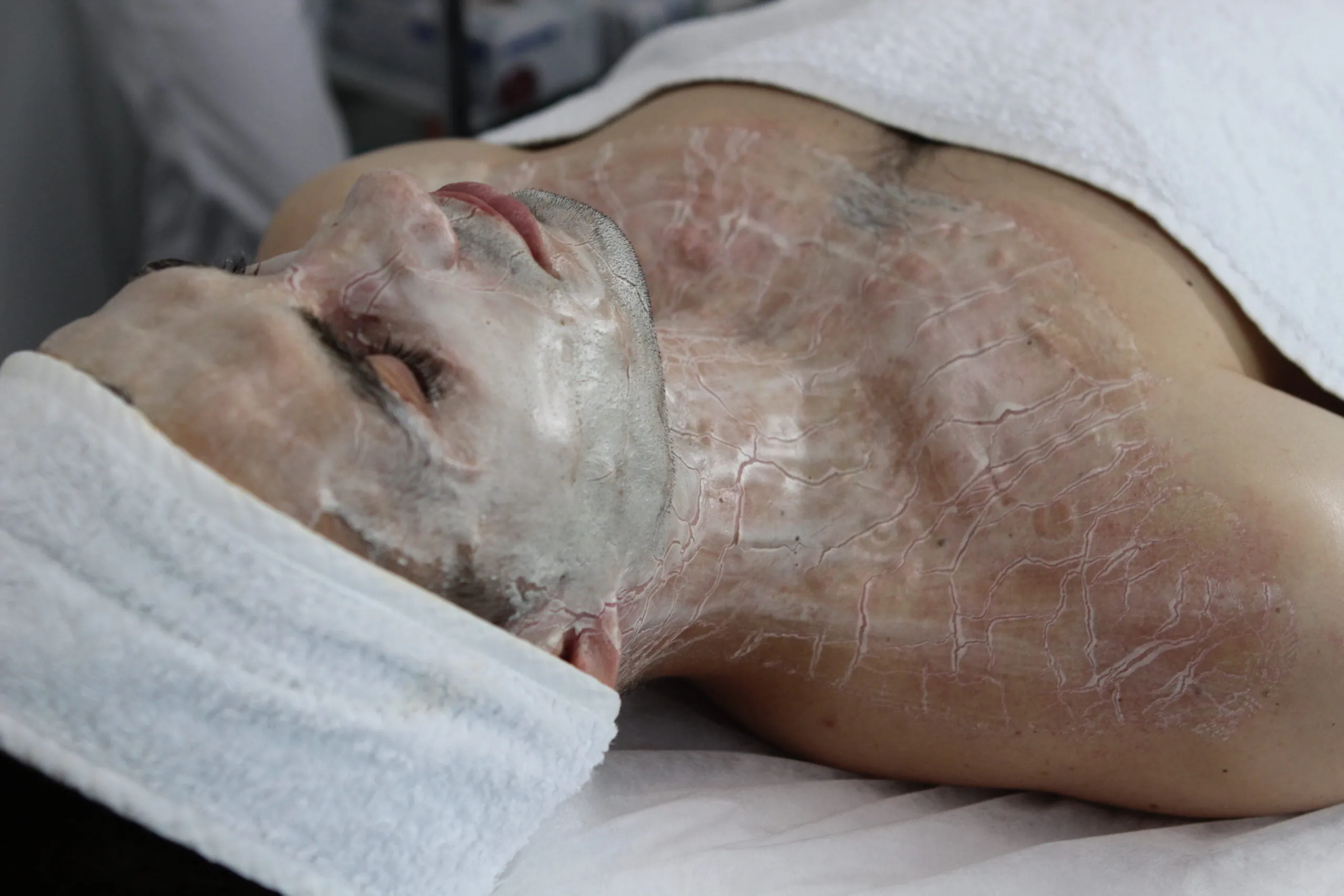 Ферментотерапія DMK