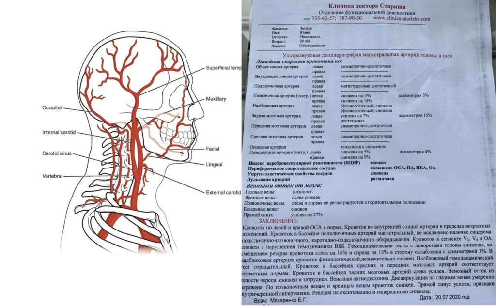 diahnostyka-porushen-krovopostachannia-holovy